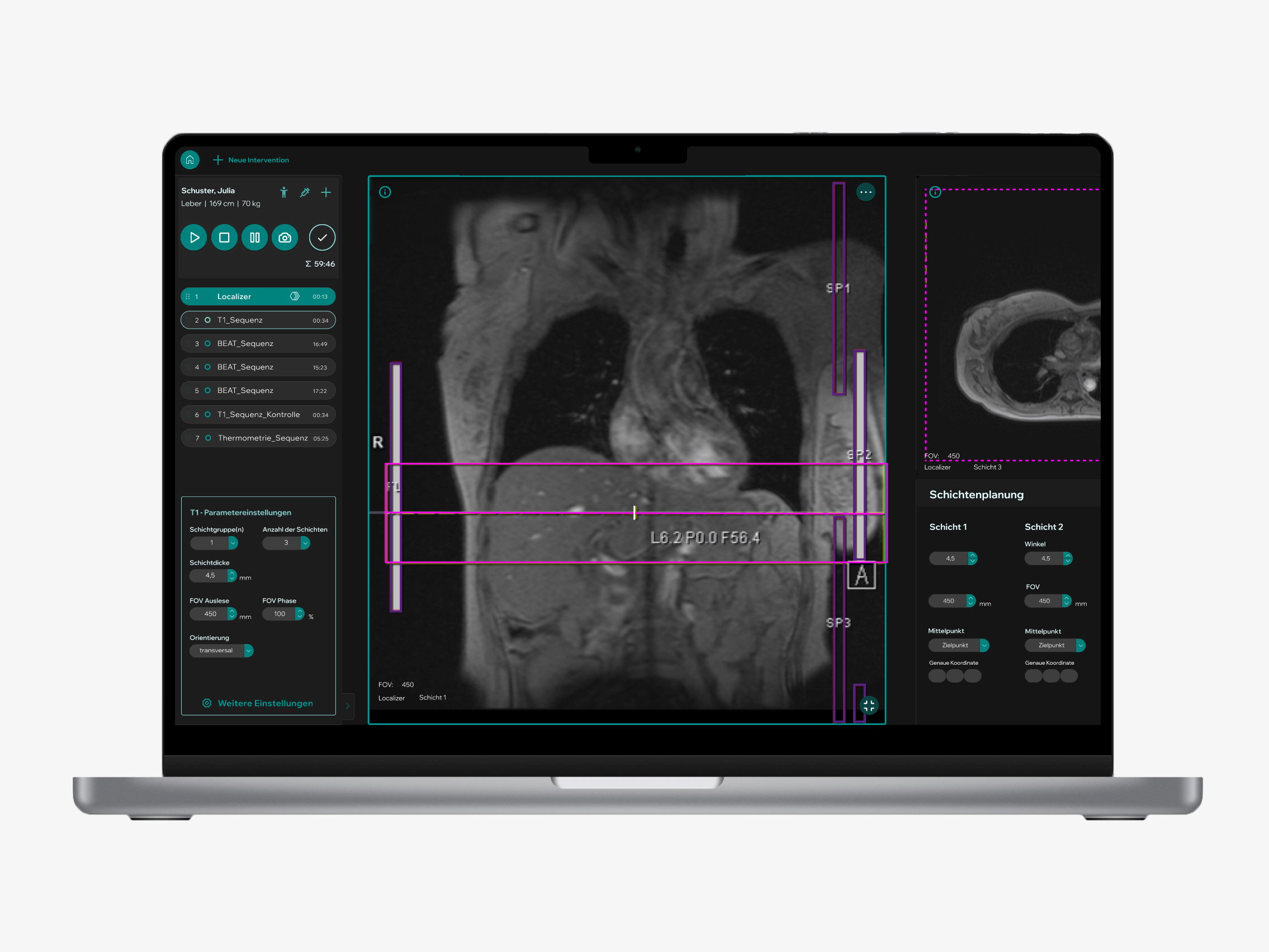 User Interface Demonstrator